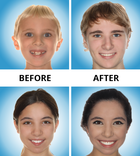 Understanding Your Braces, Dr. Blaine Langberg Orthodontics