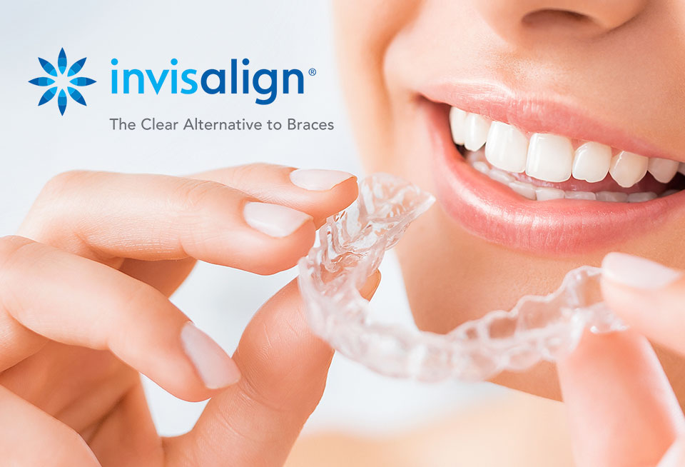 Tips Invisalign 